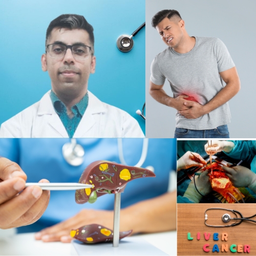 Liver cancer surgery in India