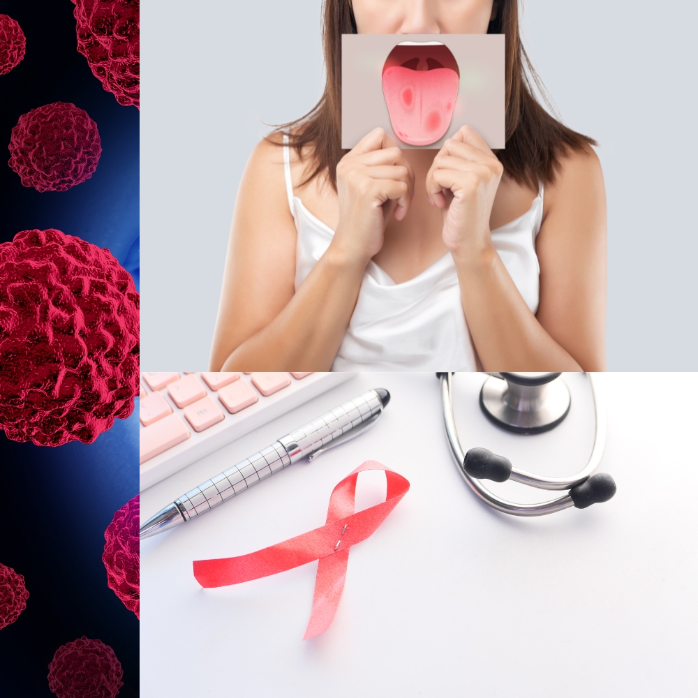 HPV and oral cancer