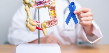 Colon Cancer