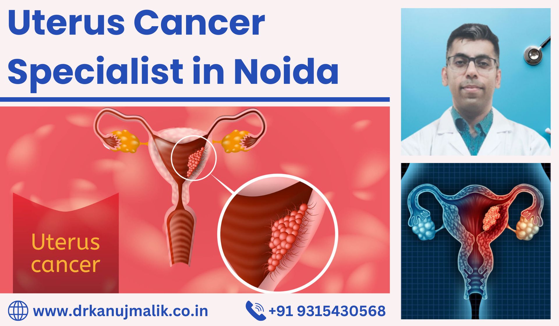 Uterus Cancer Specialist in Noida - Dr Kanuj Malik