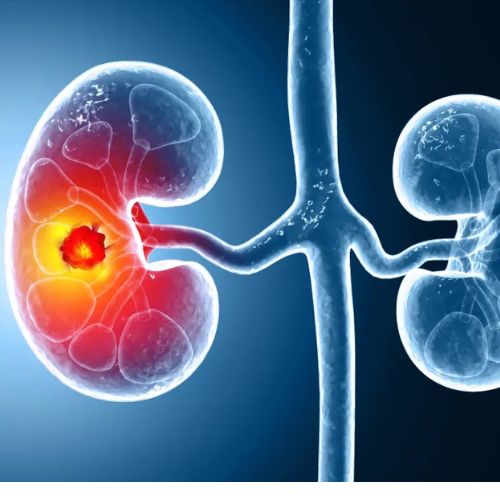 How Lifestyle Changes Can Lower Cancer Risk