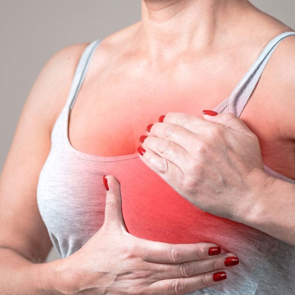 Understanding Inflammatory Breast Cancer: A Rare but Aggressive Type