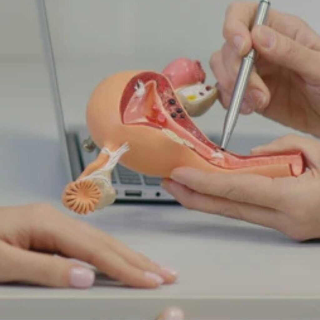 Fertility Challenges After Uterine Cancer Treatment