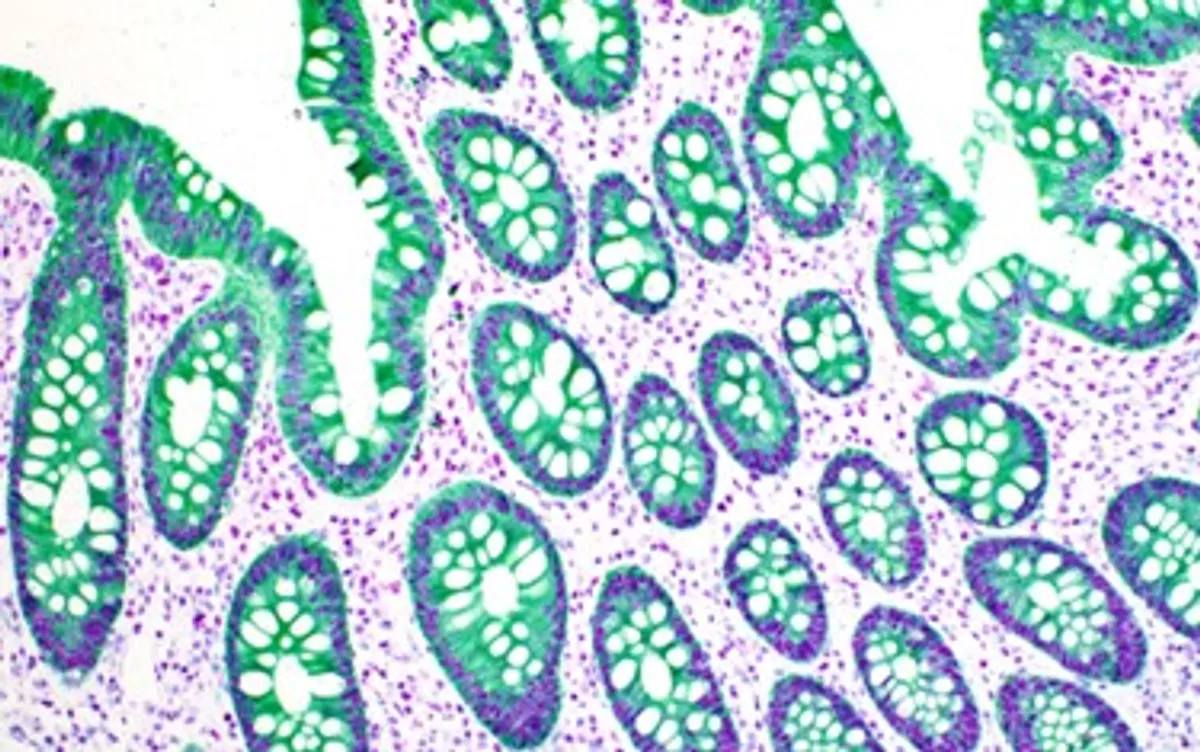 Immunohistochemistry Explained: Detecting Diseases at the Molecular Level