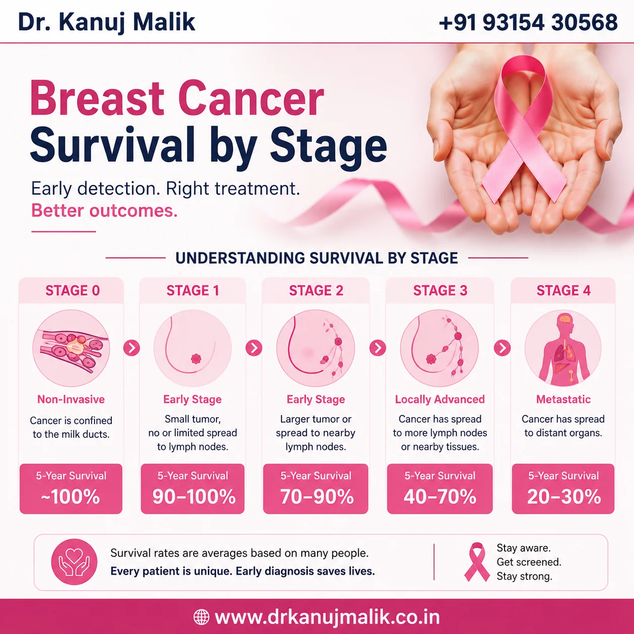 Breast Cancer Survival by Stage