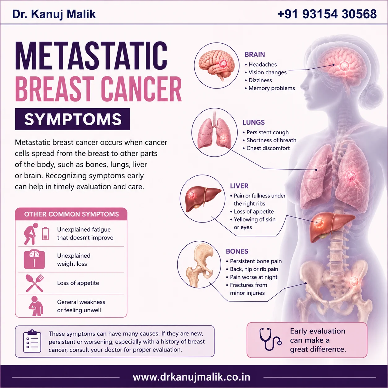 Metastatic Breast Cancer Symptoms